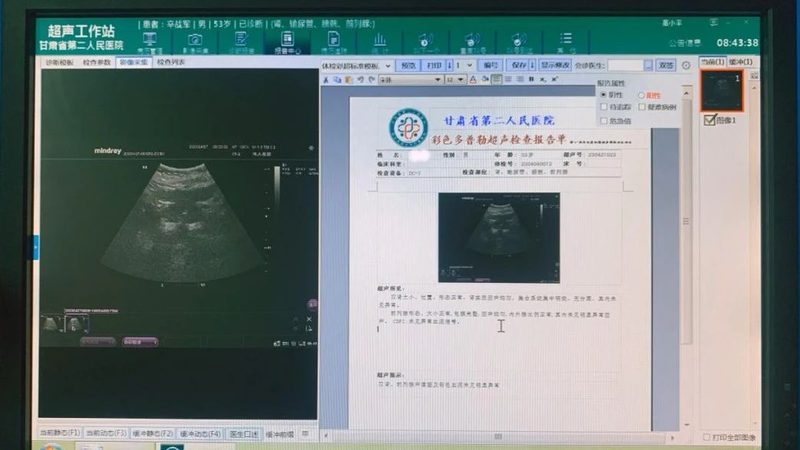 直接前往体检虽然方便快捷，但也存在一些潜在问题：